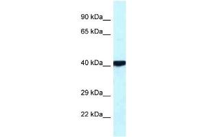 PRKACB antibody used at 1 ug/ml to detect target protein.