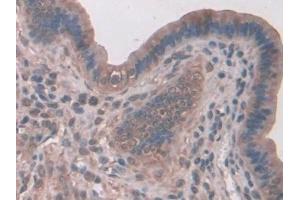 DAB staining on IHC-P; Samples: Mouse Liver Tissue (SNX18 antibody  (AA 411-614))
