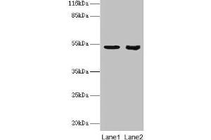 Western blot All lanes: SKP2 antibody at 2 μg/mL Lane 1: Jurkat whole cell lysate Lane 2: Hela whole cell lysate Secondary Goat polyclonal to rabbit IgG at 1/10000 dilution Predicted band size: 48, 47, 24 kDa Observed band size: 48 kDa (SKP2 antibody  (AA 1-424))