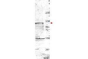 Image no. 1 for anti-Neural Precursor Cell Expressed, Developmentally Down-Regulated 4, E3 Ubiquitin Protein Ligase (NEDD4) (Internal Region) antibody (ABIN401453) (NEDD4 antibody  (Internal Region))