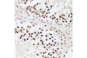 Immunohistochemistry of paraffin-embedded Rat testis using EP300 antibody (ABIN6127823, ABIN6140193, ABIN6140194 and ABIN6216844) at dilution of 1:100 (40x lens). (p300 antibody  (AA 1-270))