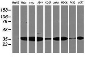 Image no. 3 for anti-Proteasome Subunit alpha 4 (PSMA4) antibody (ABIN1500458) (PSMA4 antibody)