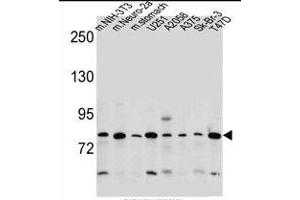 DCBLD2 Antibody (C-term) (ABIN657748 and ABIN2846732) western blot analysis in mouse NIH-3T3,Neuro-2a cell line and mouse stomach tissue and ,,,Sk-Br-3,T47D cell line lysates (35 μg/lane). (DCBLD2 antibody  (C-Term))