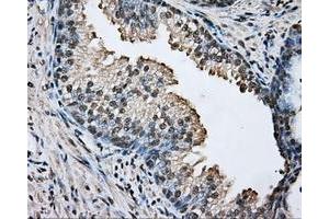 Immunohistochemical staining of paraffin-embedded prostate tissue using anti-ARNT mouse monoclonal antibody. (ARNT antibody)