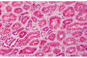 Immunohistochemistry (IHC) image for anti-Membrane Protein, Palmitoylated 5 (MAGUK P55 Subfamily Member 5) (MPP5) (N-Term) antibody (ABIN185150)