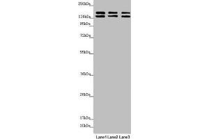 Western blot All lanes: UACA antibody at 5. (UACA antibody  (AA 1-90))