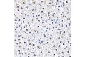 Immunohistochemistry of paraffin-embedded mouse liver using CCAR2 antibody (ABIN2563550) at dilution of 1:100 (40x lens). (CCAR2 antibody)