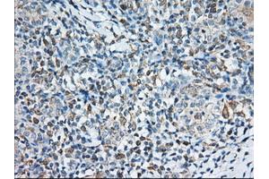 Immunohistochemical staining of paraffin-embedded Human Kidney tissue using anti-TTC32 mouse monoclonal antibody. (TTC32 antibody)