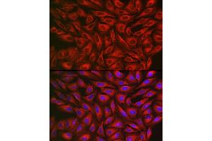 Immunofluorescence analysis of U2OS cells using FGFR3 Rabbit pAb (ABIN1679839, ABIN3015135, ABIN3015137 and ABIN6213838) at dilution of 1:100 (40x lens). (FGFR3 antibody  (AA 39-138))