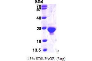 SDS-PAGE (SDS) image for Deoxyuridine Triphosphatase (DUT) (AA 70-252) protein (His tag) (ABIN667220)
