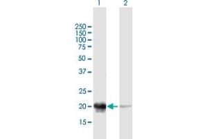 Western Blot analysis of PDC expression in transfected 293T cell line by PDC MaxPab polyclonal antibody. (Phosducin antibody  (AA 1-194))
