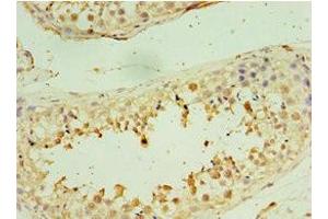 Immunohistochemistry of paraffin-embedded human testis tissue using ABIN7171228 at dilution of 1:100 (Syntaxin 16 antibody  (AA 1-300))