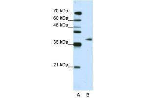 ADAT1 antibody used at 1. (ADAT1 antibody  (C-Term))