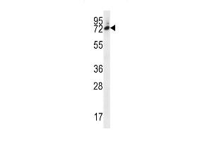 SIX5 Antibody (Center) (ABIN656668 and ABIN2845908) western blot analysis in MDA-M cell line lysates (35 μg/lane). (Six5 antibody  (AA 257-286))