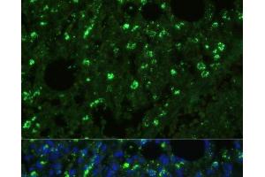 Immunofluorescence analysis of Mouse lung cells using TREM2 Polyclonal Antibody at dilution of 1:100. (TREM2 antibody)