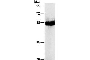 Western Blot analysis of Human colon cancer tissue using PRKAR1B Polyclonal Antibody at dilution of 1:1200 (PRKAR1B antibody)