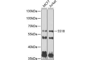 Western blot analysis of extracts of various cell lines, using SS18 antibody (ABIN6133185, ABIN6148473, ABIN6148474 and ABIN6222754) at 1:1000 dilution. (SS18 antibody  (AA 1-240))