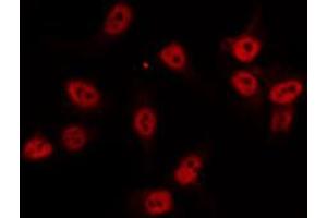 ABIN6274520 staining Hela by IF/ICC. (AKIP1 antibody  (Internal Region))