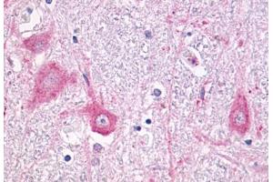 Anti-GRM5 / MGLUR5 antibody  ABIN1048937 IHC staining of human brain, neurons and glia.