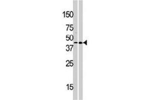 Western blot analysis of MOS polyclonal antibody  in 293 (right) and Hela (right) cell line lysate (35 ug/lane). (MOS antibody  (N-Term))