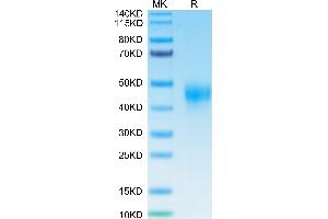 TFPI Protein (His-Avi Tag)