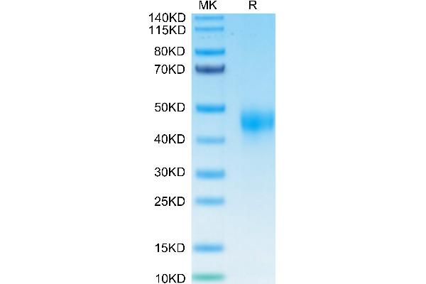 TFPI Protein (His-Avi Tag)