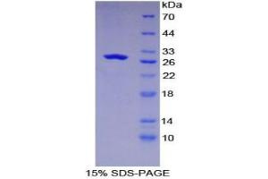 SDS-PAGE analysis of Human GLUD1 Protein.