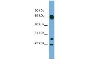 WB Suggested Anti-MMP26  Antibody Titration: 0. (MMP26 antibody  (C-Term))
