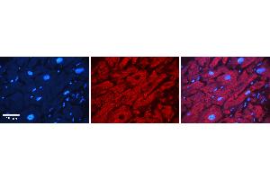 Rabbit Anti-ATXN2 Antibody   Formalin Fixed Paraffin Embedded Tissue: Human heart Tissue Observed Staining: Cytoplasmic Primary Antibody Concentration: N/A Other Working Concentrations: 1:600 Secondary Antibody: Donkey anti-Rabbit-Cy3 Secondary Antibody Concentration: 1:200 Magnification: 20X Exposure Time: 0. (Ataxin 2 antibody  (Middle Region))