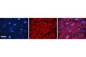 Rabbit Anti-ATXN2 Antibody   Formalin Fixed Paraffin Embedded Tissue: Human heart Tissue Observed Staining: Cytoplasmic Primary Antibody Concentration: N/A Other Working Concentrations: 1:600 Secondary Antibody: Donkey anti-Rabbit-Cy3 Secondary Antibody Concentration: 1:200 Magnification: 20X Exposure Time: 0.