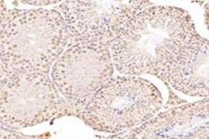 Immunohistochemistry (Paraffin-embedded Sections) (IHC (p)) image for anti-Mediator Complex Subunit 27 (MED27) antibody (ABIN7074581)