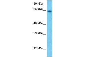 Host:  Rabbit  Target Name:  GUCY1B3  Sample Tissue:  Human HepG2 Whole cell  Antibody Dilution:  1ug/ml