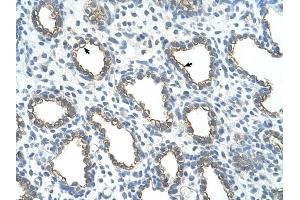UBE2J1 antibody was used for immunohistochemistry at a concentration of 4-8 ug/ml to stain Alveolar cells (arrows) in Human Lung. (UBE2J1 antibody)
