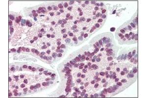Immunohistochemistry (IHC) image for anti-X-Box Binding Protein 1 (XBP1) (AA 2-160) antibody (ABIN492538) (XBP1 antibody  (AA 2-160))