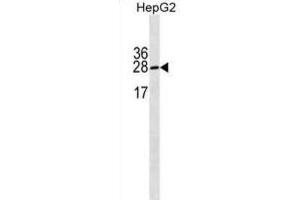 Western Blotting (WB) image for anti-Immunoglobulin lambda-Like Polypeptide 5 (IGLL5) antibody (ABIN3000244) (IGLL5 antibody)