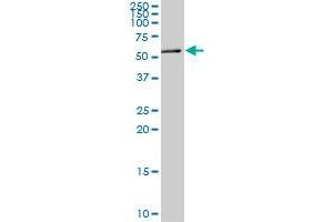 MEF2A monoclonal antibody (M08), clone 1F8. (MEF2A antibody  (AA 71-170))