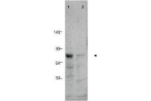 Western blot using  Affinity Purified anti-BORIS antibody shows detection of a predominant band corresponding to BORIS in human tissue lysates (arrowhead). (CTCFL antibody  (AA 9-26))