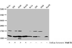Western Blot Detected samples: Hela whole cell lysate, 293 whole cell lysate, A549 whole cell lysate, HepG2 whole cell lysate, Untreated (-) or treated (+) with 30 mM sodium butyrate for 4h All lanes: HIST1H4A antibody at 1:100 Secondary Goat polyclonal to rabbit IgG at 1/50000 dilution Predicted band size: 12 kDa Observed band size: 12 kDa (HIST1H4A antibody  (acLys31))
