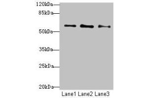 Western blot All lanes: GPR101 antibody at 6 μg/mL Lane 1: MCF-7 whole cell lysate Lane 2: U87 whole cell lysate Lane 3: Caco-2 whole cell lysate Secondary Goat polyclonal to rabbit IgG at 1/10000 dilution Predicted band size: 57 kDa Observed band size: 57 kDa (F2RL1 antibody  (AA 218-399))