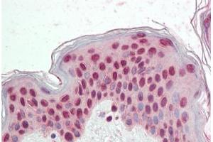 Human Skin: Formalin-Fixed, Paraffin-Embedded (FFPE)