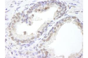 Immunohistochemistry (IHC) image for anti-Ubiquitin Specific Peptidase 47 (USP47) (C-Term) antibody (ABIN7449031)