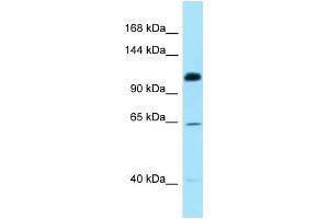 WB Suggested Anti-SMC6 Antibody Titration: 1.