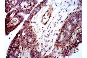 Immunohistochemistry (IHC) image for anti-Integrin beta 1 (ITGB1) antibody (ABIN1844058) (ITGB1 antibody)