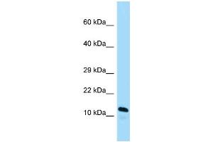 WB Suggested Anti-Arl2bp Antibody Titration: 1. (ARL2BP antibody  (C-Term))