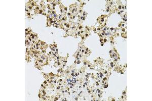 Immunohistochemistry of paraffin-embedded rat lung using ZNF408 antibody (ABIN5974874) at dilution of 1/100 (40x lens). (ZNF408 antibody)