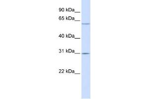 WB Suggested Anti-TMEM106C Antibody Titration:  0. (TMEM106C antibody  (Middle Region))