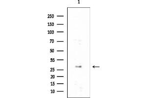 anti-TIP41-like protein (TIPRL) antibody