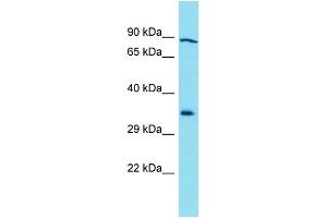 Western Blotting (WB) image for anti-Galactosidase, beta 1-Like 3 (GLB1L3) (C-Term) antibody (ABIN2791555) (GLB1L3 antibody  (C-Term))