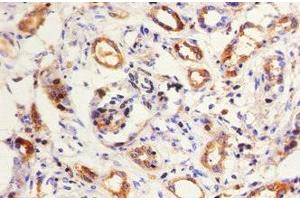 Immunohistochemistry of paraffin-embedded human kidney tissue using ABIN7157681 at dilution of 1:50 (KNG1 antibody  (AA 390-644))
