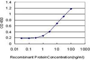 Detection limit for recombinant GST tagged IRAK3 is approximately 0. (IRAK3 antibody  (AA 497-596))